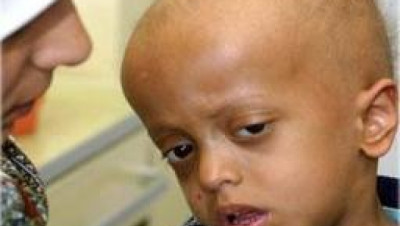 الحوثيون يقتلون عشرات الأطفال المصابين بالسرطان