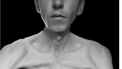 "قد يموت قريبا" خبراء الأمم المتحدة يطالبون بالإفراج عن إيراني ـ سويدي