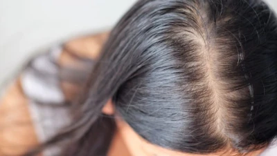 تفسير حلم تساقط الشعر بغزارة للعزباء والمتزوجة