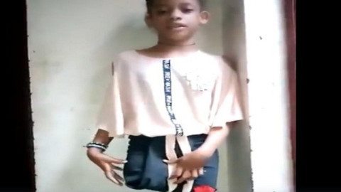 بالفيديو.. طفلة يمنية فقدت ساق...