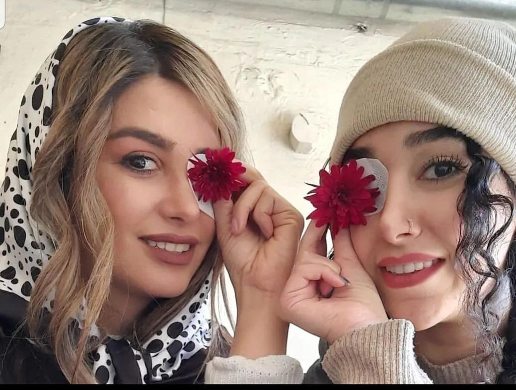 أعين المحتجين في إيران هدف رئيسي لرصاص القوات الأمنية